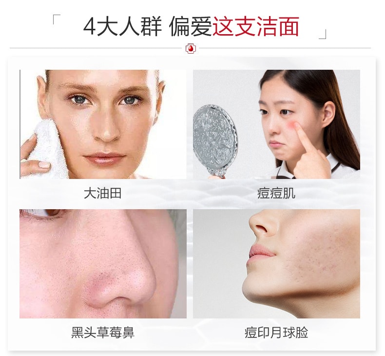 [中国直邮]薇诺娜(WINONA) 净痘清颜洁面乳  80g 1支装