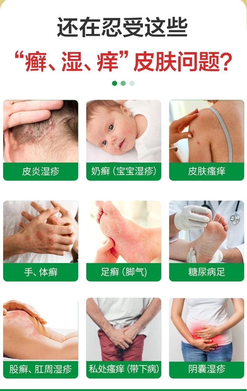 【中国直邮】 太阳 绿 肤痔清软膏 消痔疮药膏 苗药除湿止痒手足癣体股癣儿童湿疹 10g/盒