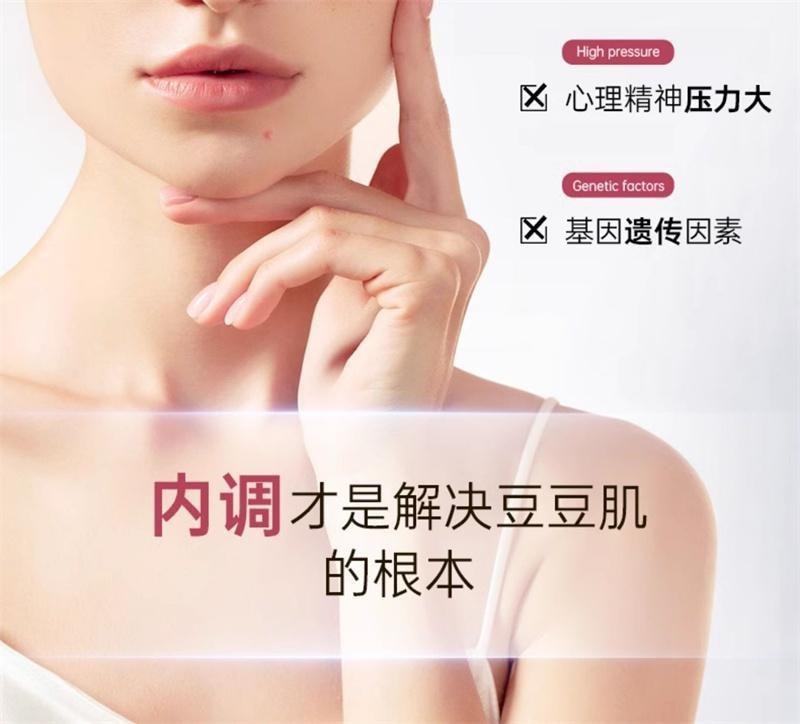 【中国直邮】 碧维斯 净痘胶囊 男女控油净痘粉刺淡化痘印收缩毛孔 60粒/盒