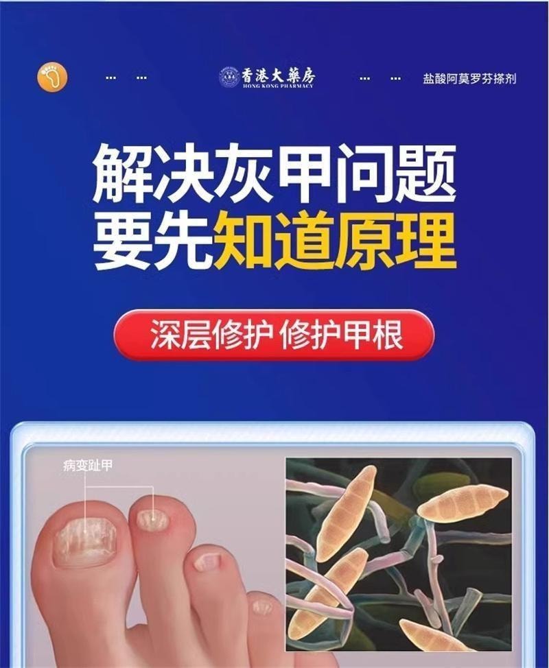 【中國直郵】 香港大藥房 鹽酸阿莫羅芬搽劑 灰指甲專用藥腳氣甲癬甲真菌病 30ml/盒(養成好甲)