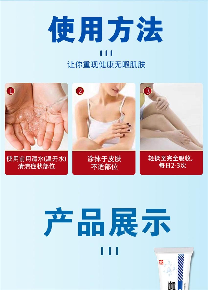 【中国直邮】 祥医堂 地奈德乳膏 适用于神经性皮炎 湿疹 皮肤瘙痒药膏 15g/盒(医师推荐拍3盒)