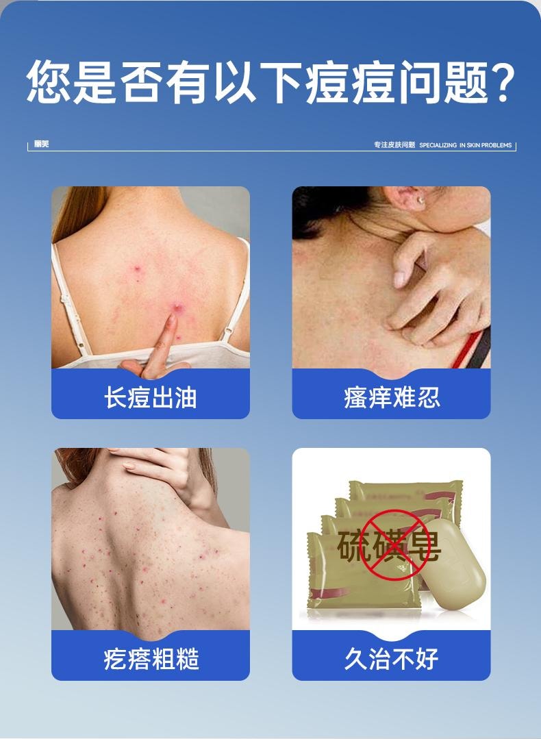 【中國直郵】 麗芙 克林黴素磷酸酯外用溶液 用於毛囊炎前胸後背祛痘噴霧背部祛痘除蟎 30ml/盒
