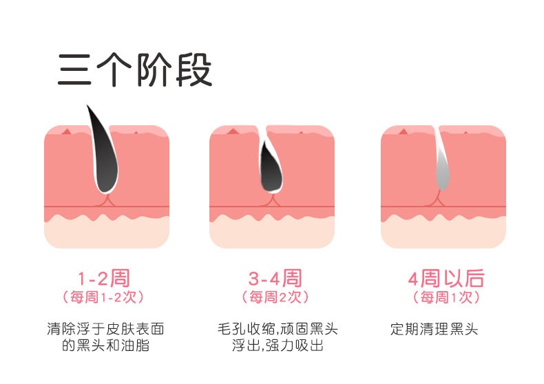 【中国直邮】北欧欧慕 可视化黑头洁面仪电动毛孔清洁器 白色款