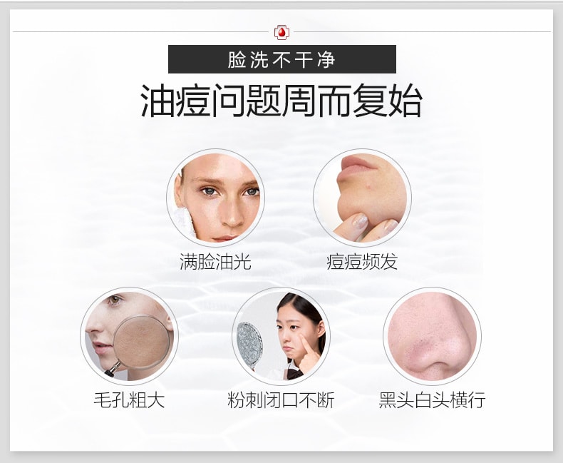 [中国直邮]薇诺娜(WINONA) 净痘清颜洁面乳  80g 1支装