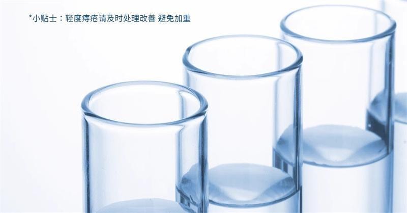 【中国直邮】 丁达尔 医用卡波姆痔疮敷料 痔疮膏 舒肿缓痛 散热解表 用于内球外型混合型 20g/盒