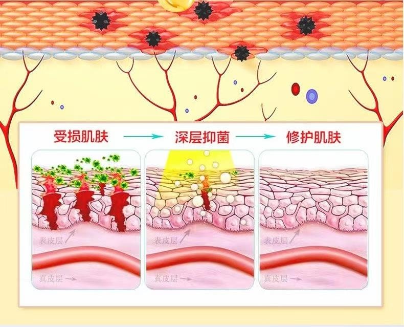 Fish Stone Fat Ointment 20g Plant Herbal Cream Mild Cream Pain Relief Pus Removal Skin External Use Itching Antibacteria