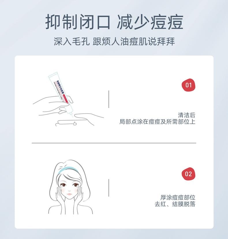 【中國直郵】 軍獻 精華祛痘膏25g 去閉口粉刺紅腫油痘肌