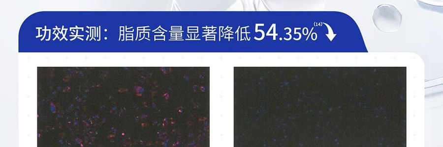 VOOLGA敷尔佳 清痘净肤次抛精华 2.0 1.5ml*30支 速效祛痘淡印 控油舒缓 油痘敏感肌适用