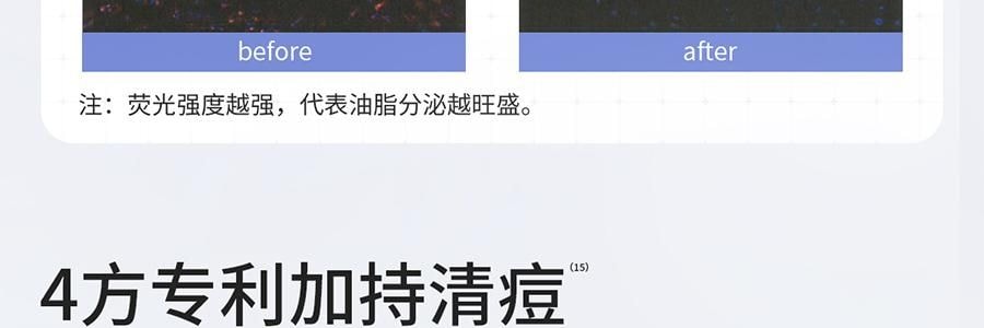 VOOLGA敷尔佳 清痘净肤次抛精华 2.0 1.5ml*30支 速效祛痘淡印 控油舒缓 油痘敏感肌适用