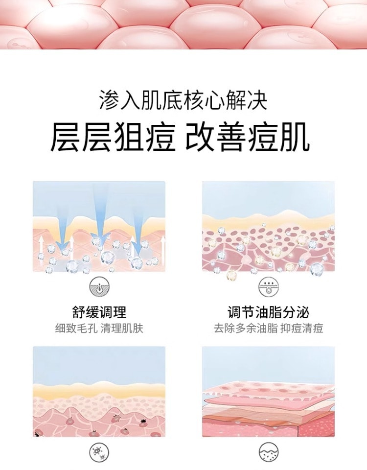 【中国直邮】美研因式 复合酸祛痘凝胶 控油清痘淡化痘印 舒缓修护细致毛孔 15g/支 (七老板推荐)