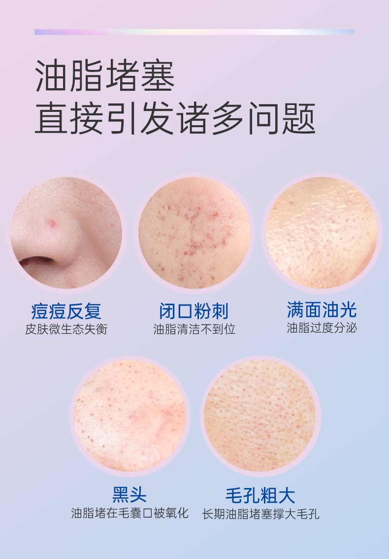 [中国直邮]芙清密钥 FulQun 水杨酸果酸换肤面膜 涂抹控油清洁肌肤 30g 1支装