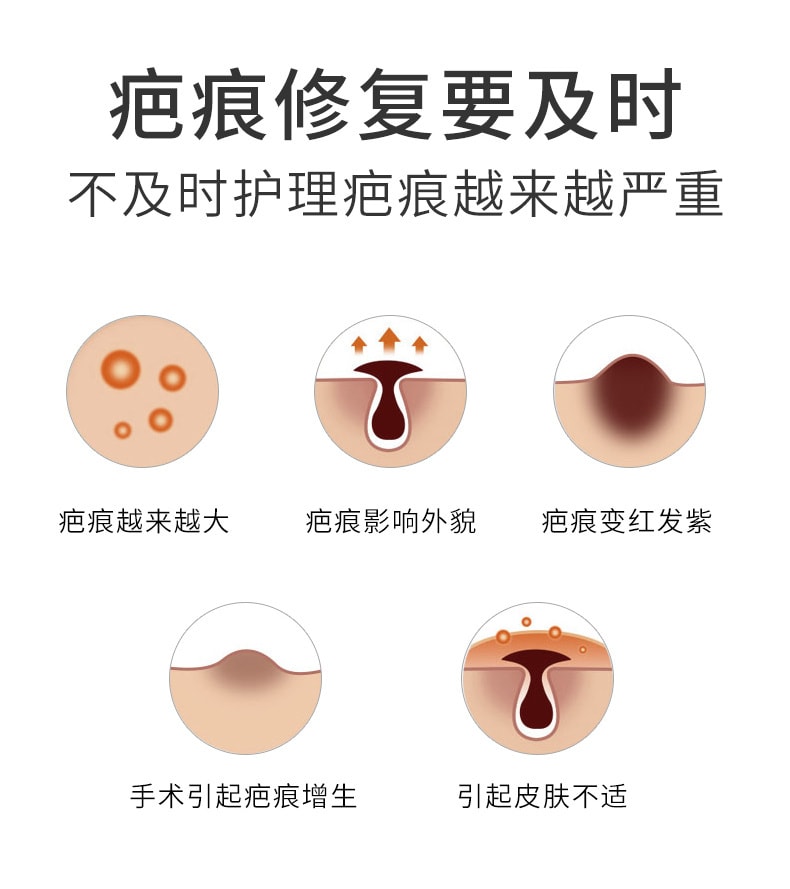 Medical Silicone Gel Dressing For Surgical Bump Removal 20g/Pc