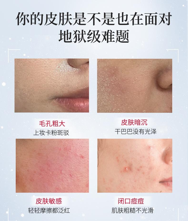 【日本直郵】 日本 NARIS UP 娜麗絲 果酸拋光水 角質調理毛孔收縮保濕保濕舒緩爽膚 保濕型 化妝水 200ml