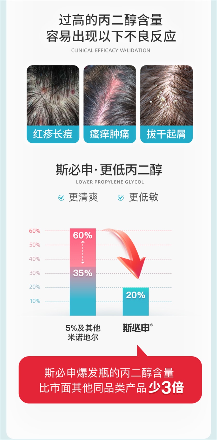 【中国直邮】斯必申  米诺地尔酊搽剂生发液女性2%防脱发生发液洗发水  100ml/瓶