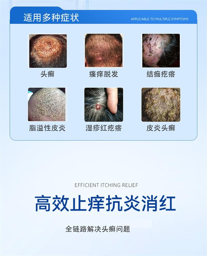 修正 美国  头皮屑脂溢性皮炎真菌感染非药膏治头部银屑癣皮肤痒毛囊炎特效药卡波姆皮肤湿性敷料 20ml