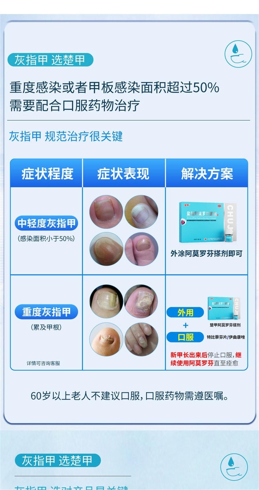 【中國直郵】 楚甲 鹽酸阿莫羅芬搽劑1ml治療灰指甲專用藥增厚甲癬 1mL x 1盒
