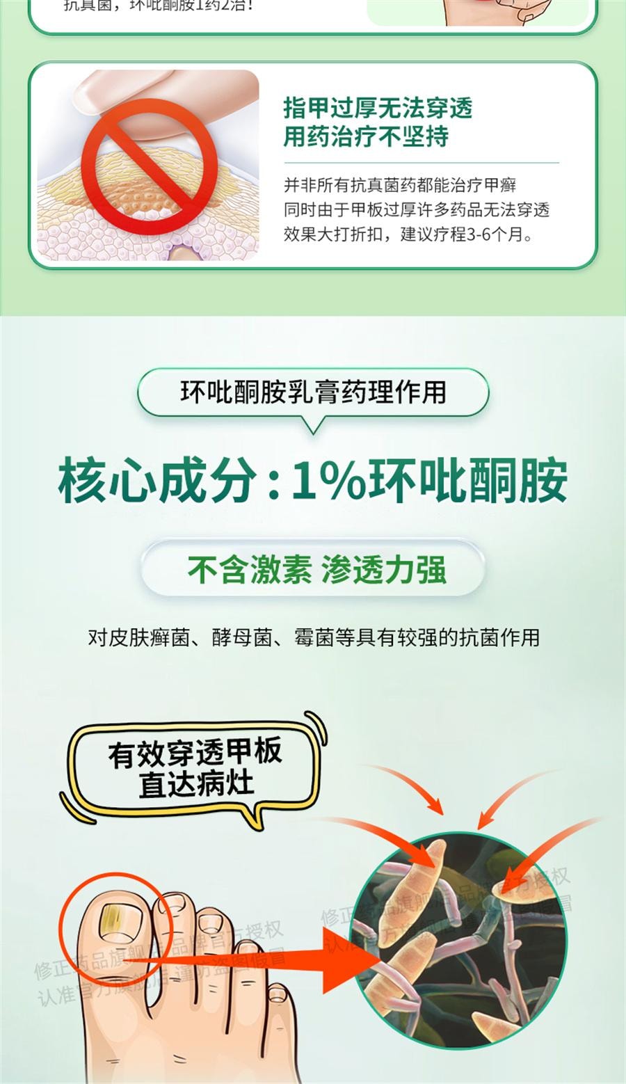 【中国直邮】 修正 环吡酮胺乳膏治脚气止痒脱皮杀菌专用药膏真菌感染水泡灰指甲  15g/支