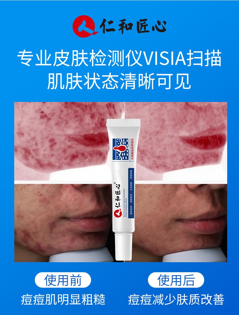 【中国直邮】仁和 水杨酸祛痘调理乳淡化痘肌痘印温和去痘痘30g (买二送一)