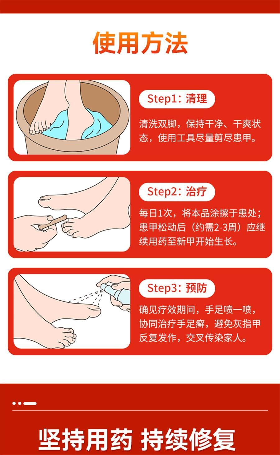 【中国直邮】 太平 硝酸咪康唑乳膏 治疗灰指甲专用药甲硝酸咪康唑乳膏烂脚丫10g/盒