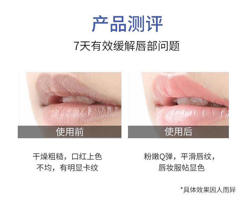 【日本直邮】SHISEIDO资生堂 MOILIP修保湿修复型润唇膏 8g