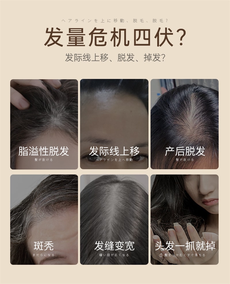 【中國直郵】 儒意 蔓濃烏發育髮液 頭髮際線營養劑發增密快速增長多男女生防脫神器 100ml/瓶(2瓶裝)