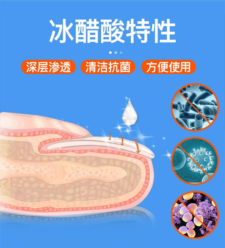 【中国直邮】 欧诺康 30%冰醋酸溶液涂剂抗菌剂 外用泡脚甲部护理 杀菌修复 100ml/盒