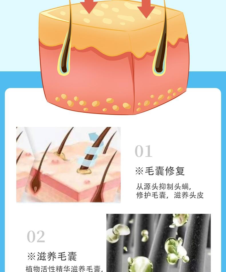 【中国直邮】 祥医堂 苦参碱洗发水 含碱pca锌洗发水 洗头去屑止痒苦渗减正品 110ml/盒
