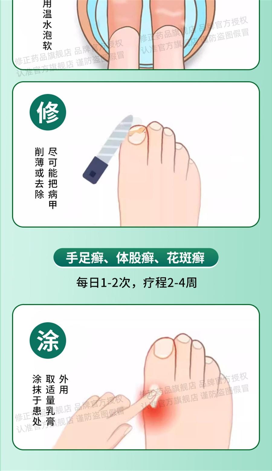 【中国直邮】 修正 环吡酮胺乳膏治脚气止痒脱皮杀菌专用药膏真菌感染水泡灰指甲  15g/支