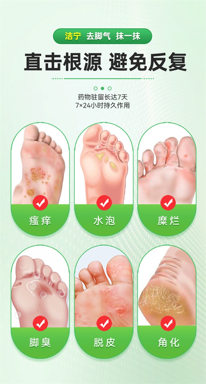 【中国直邮】 鲁南 乳膏 治疗脚气止痒脱皮杀菌脚臭脚痒真菌感染专用药10gx 1盒
