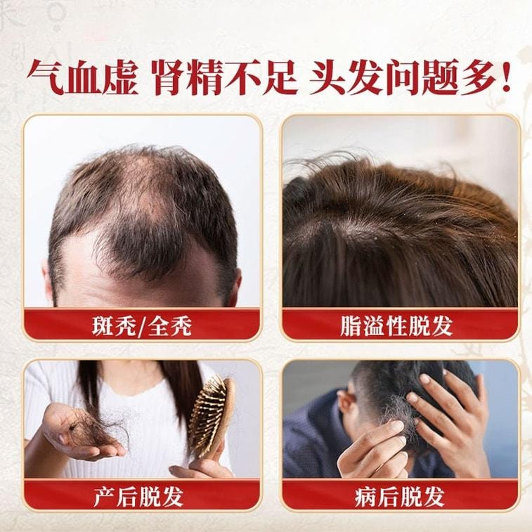 Yangxue Shengfa Capsules: 30 Capsules for Nourishing Blood Benefiting the Kidney and Filling Essence