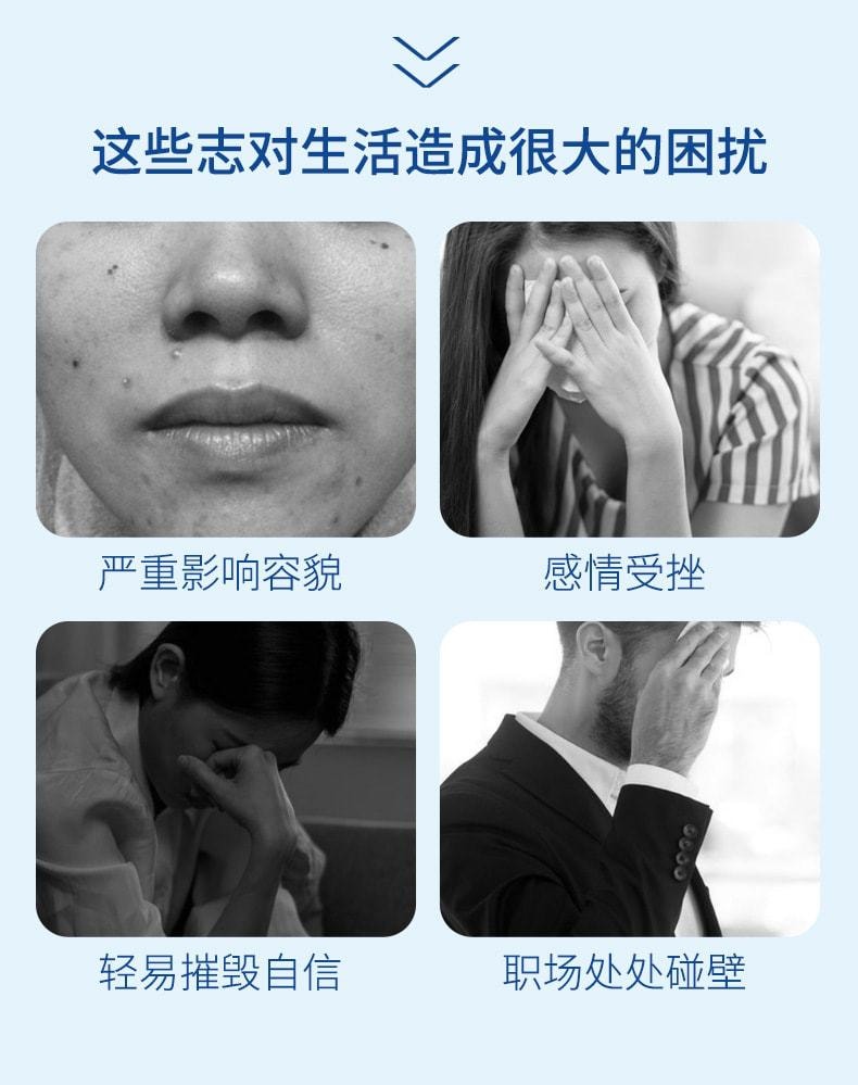【中国直邮】南京同仁堂 新品 点志宁套装5ml+5g 祛痣无痛不留痕