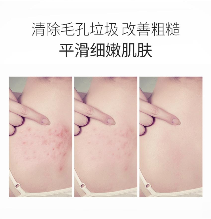 【中国直邮】 朵拉朵尚 竹炭皂+茶树皂 深层清洁毛孔 男女士面部香皂全身洗澡沐浴肥皂 110g+110g