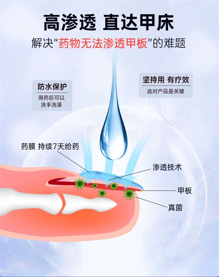 【中國直郵】有時力 5%鹽酸阿莫羅芬搽劑 2.2ml治療灰指甲專用藥特效 2.2ML/盒
