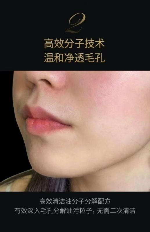 【中国直邮】 儒意 植物黑茶卸妆油洁颜油 以油卸妆养卸二合一 清洁温和不刺激眼唇脸部去黑头卸妆水185ml
