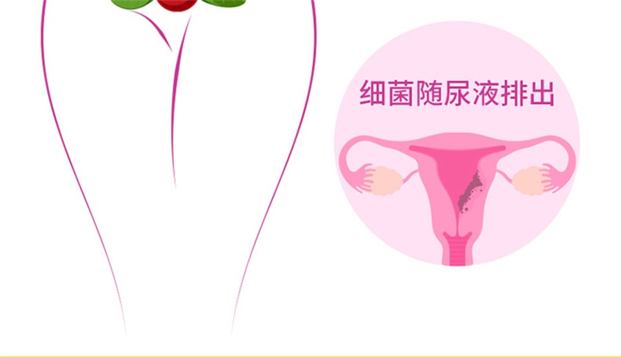 【中国直邮】Youthit优思益 高浓度蔓越莓胶囊65000女性泌尿健康 60粒 玻璃瓶