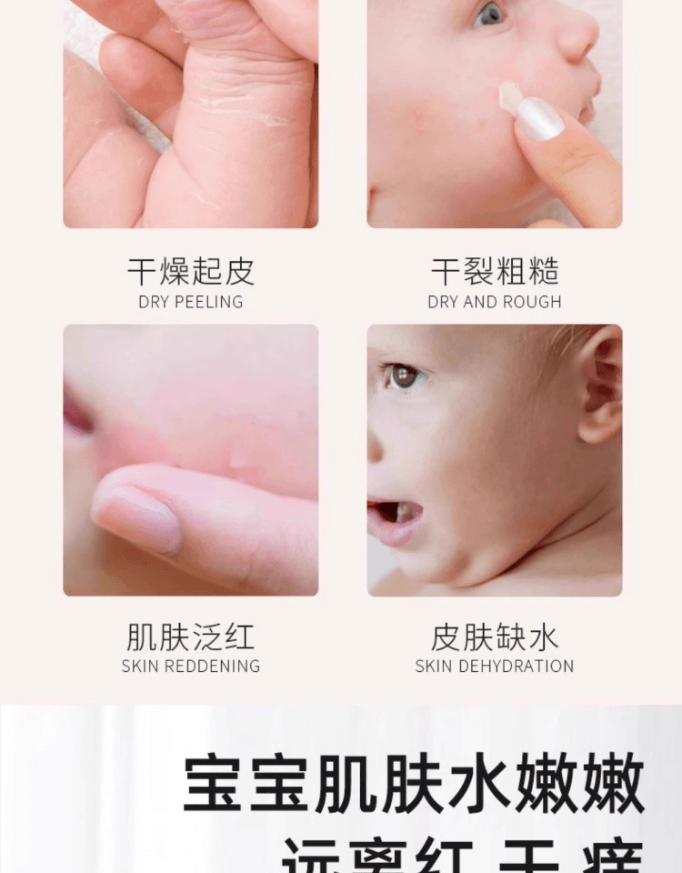 【中國直郵】 春娟 水潤保濕兒童乳液78g*1