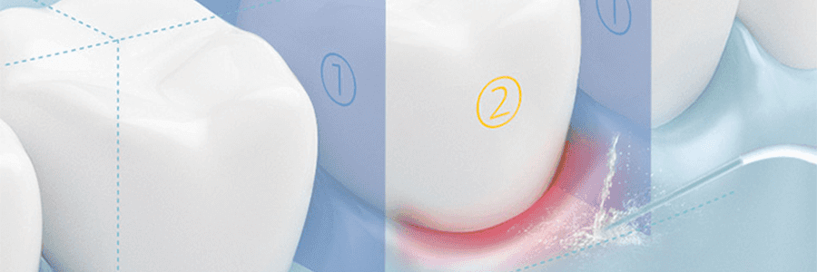 USMILE 密浪水牙線 便攜沖牙器 家用超音波洗牙潔牙 漸變色【新手必入】