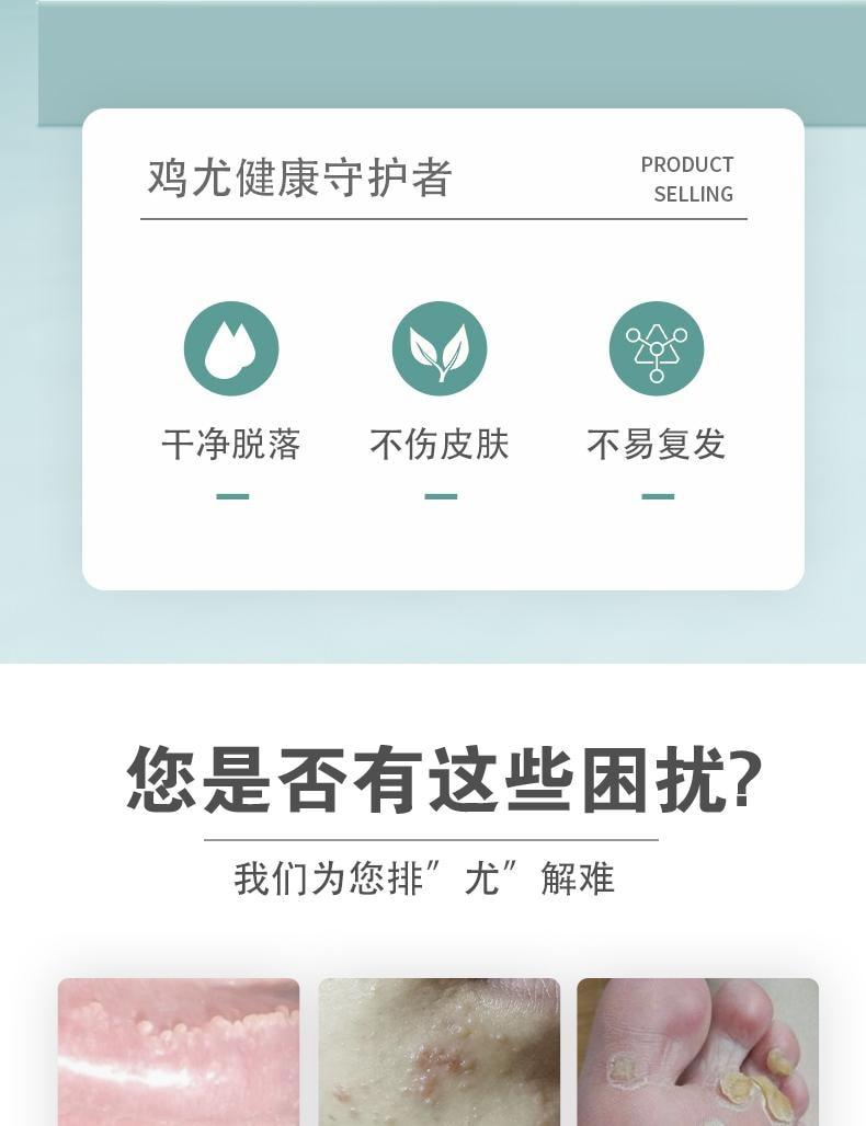 【中国直邮】 祥医堂 疣清宁 扁平尤乳膏 去尤瘊小肉粒神器疣膏 轻松应对各种疣痕问题 20g/盒
