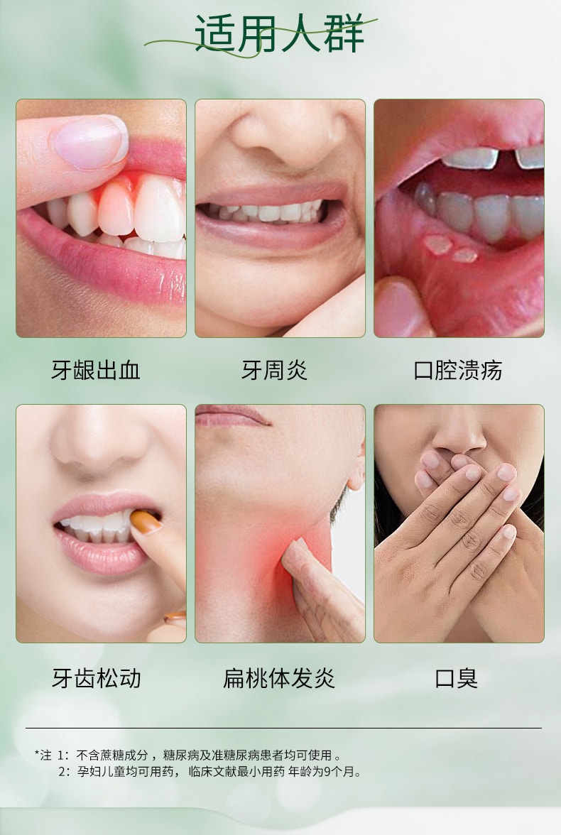 【中國直郵】 奇康 西帕依固齦液 用於牙齦出血口腔潰瘍牙疼消腫牙周炎藥 30ml/盒