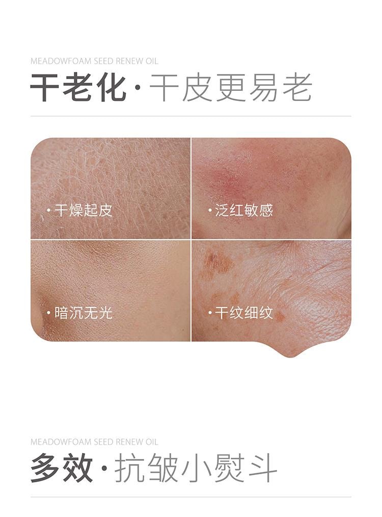 【中國直郵】 米立 934/943白池花精萃精華油30ml 油養修護 彈潤緊緻不垮臉 清除自由基