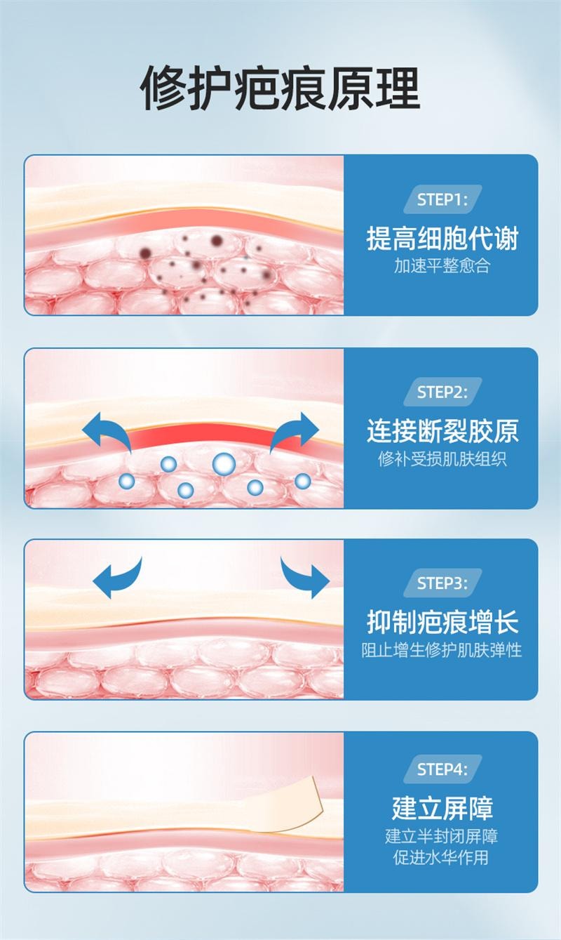 【中国直邮】 亿普 疤痕贴 医用祛疤贴 硅凝胶剖腹产去疤修复儿童手术增生除疤隐形贴 3贴/盒