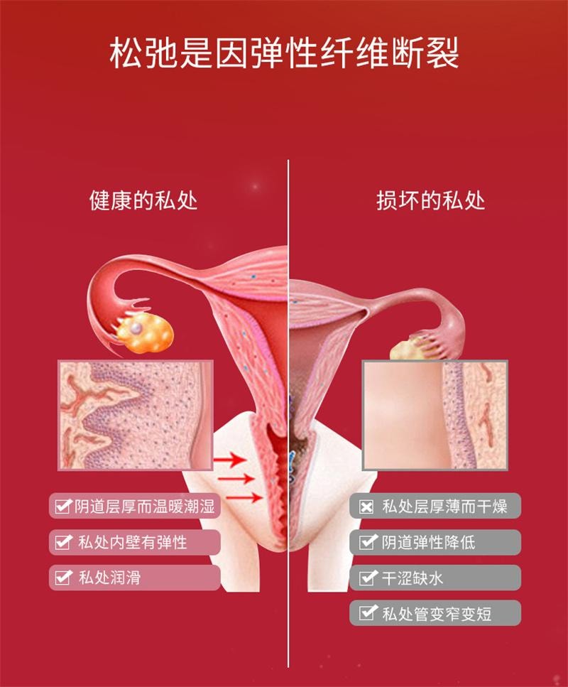 【中国直邮】 舒奈美 紧润丹 妇科凝胶女性私密粉嫩缩Y丹阴道私处护理液   12粒/盒