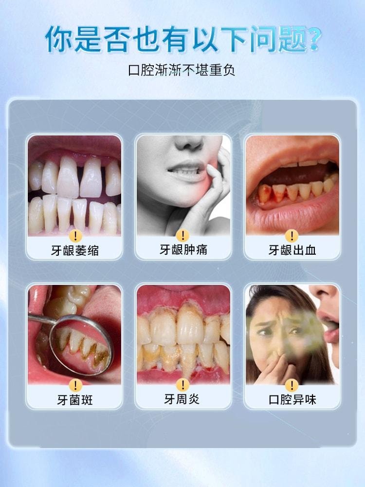 【中國直郵】 康齒寧 丁硼乳膏 刷掉牙菌斑 改善牙齦健康 用於口腔牙齦出血牙周炎去除口臭 70g/盒