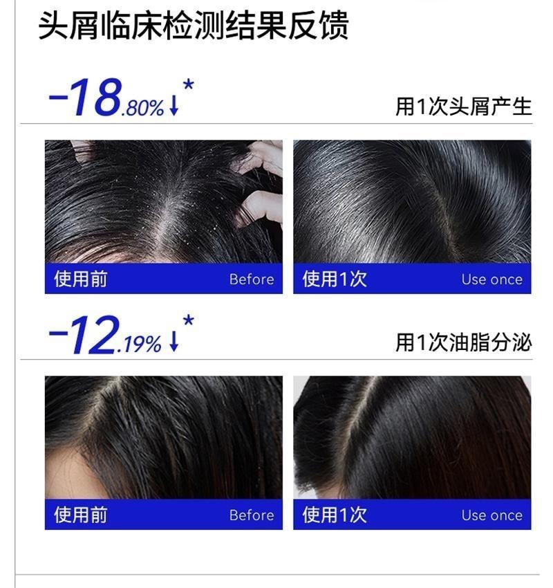 【中国直邮】 EHD 二硫化硒 控油去屑洗发水 毛囊清洁蓬松洗头露膏男女 400ml/瓶