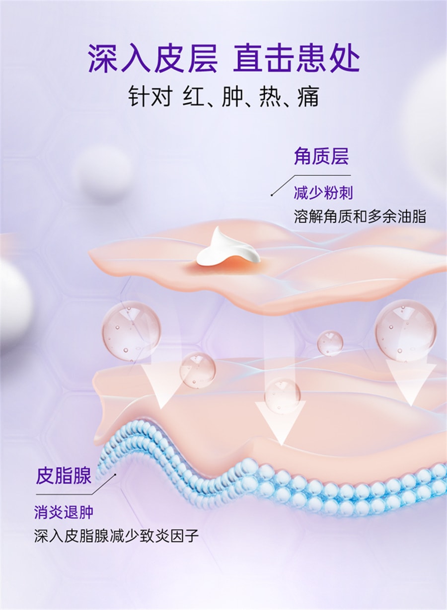 【中国直邮】班赛  过氧苯甲酰凝胶进口原研祛痘消炎药膏祛痘印修复淡化痘印男女  过氧苯甲酰凝胶15g+阿达帕林凝胶30g
