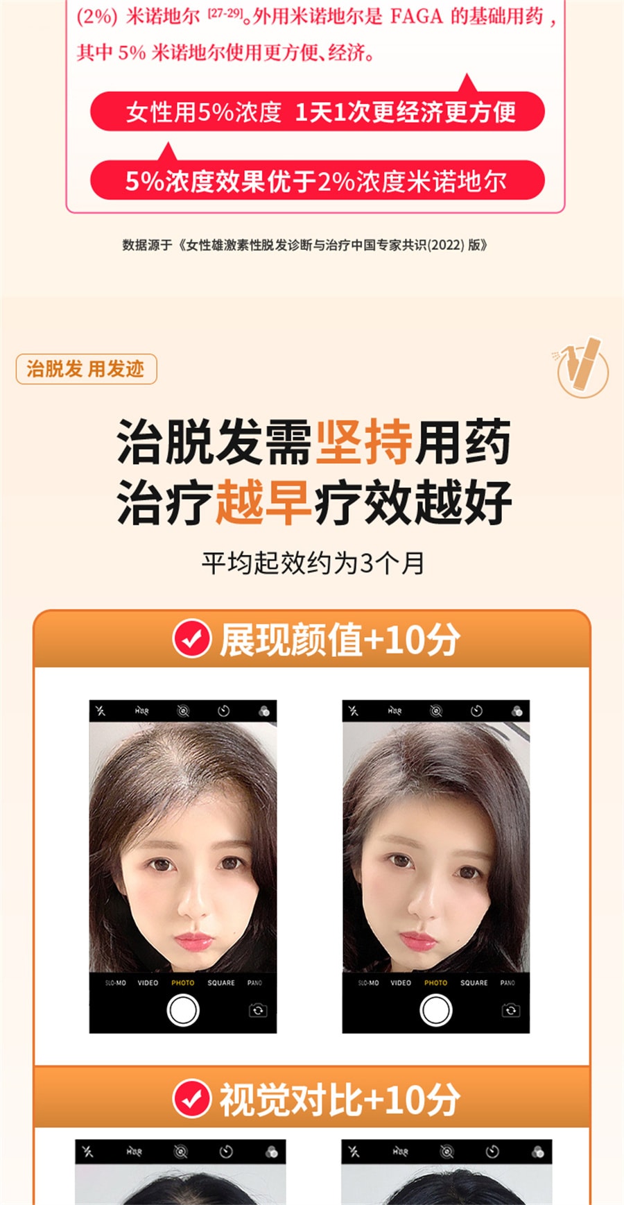 【中国直邮】发迹 米诺地尔酊生发液正品5%男女性町米洛若丁地尓原液  5%*90ml/盒