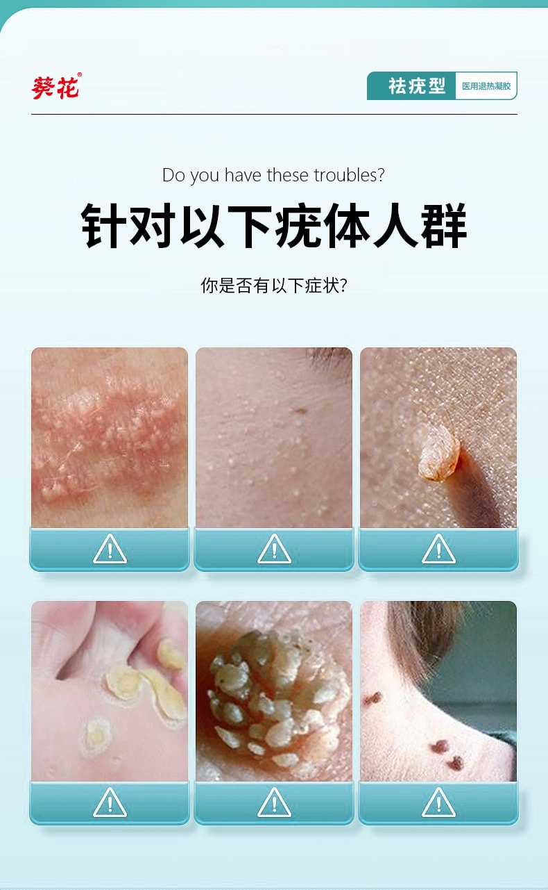 葵花 扁疣去除膏一抹靈去尤瘊去疣藥膏去脖子上長小肉粒軟膏藥水 20g/支