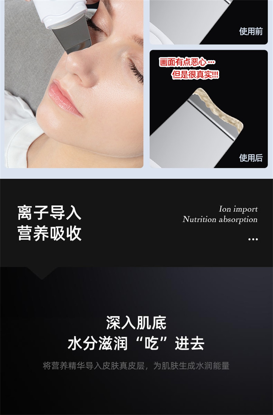 にきび、汚れ、毛穴、クレンジング器具を取り除く超音波シャベル