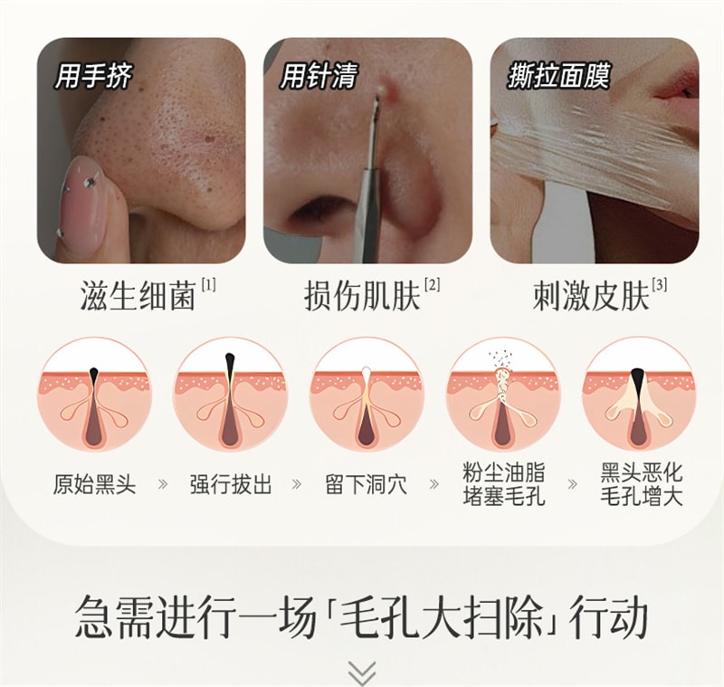 【中国直邮】 儒意 多酸净颜清肤泥膜 去黑白头闭口粉刺收缩深层清洁毛孔涂抹式积雪草清洁面膜 150g/瓶