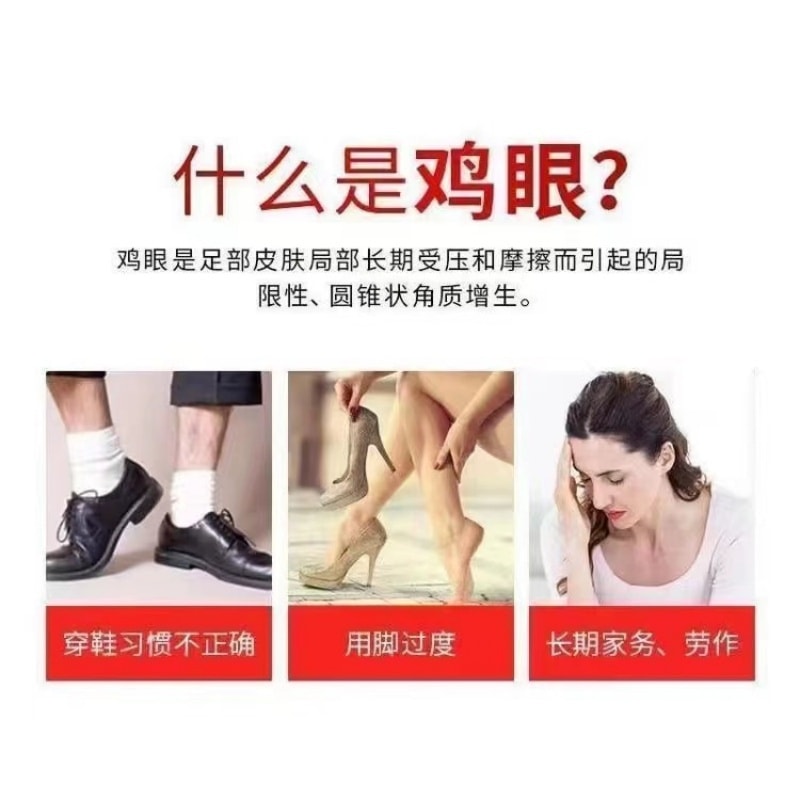 Acupoint Pressure Corns Patches For Hand And Foot Elimination 6 Patches/box